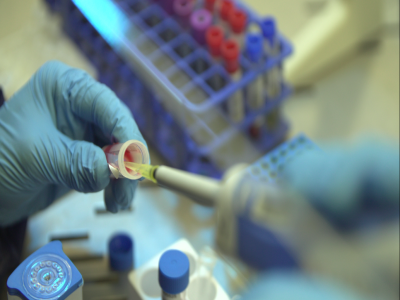 Collection and transport of samples